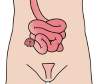 Ileostomie